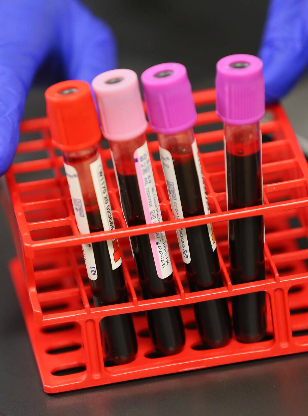 Vials of blood samples from a donor await to be sent out for coronavirus antibody testing at the Vitalant blood donation center in Santa Rosa on Tuesday, June 9, 2020. (Christopher Chung / The Press Democrat)